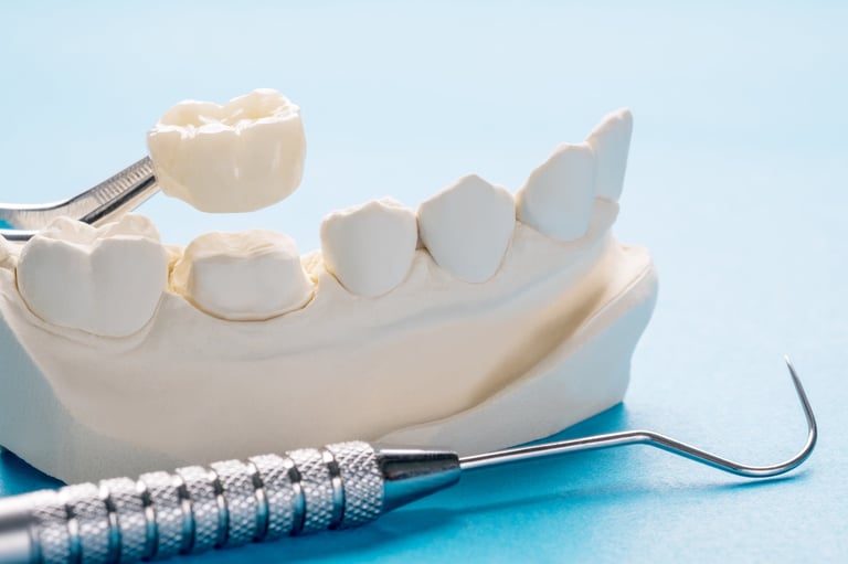 Closeup of single teeth crown and bridge equipment model for dental restoration