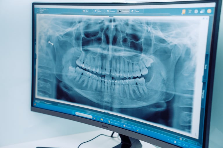 Dental X-ray image displayed on a monitor showing a panoramic view of teeth and jaw structure